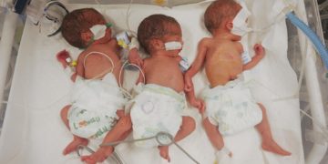 غزة: انهيار في عدد الولادات وتضاعف مقلق في وفيات الأمهات والرضّع